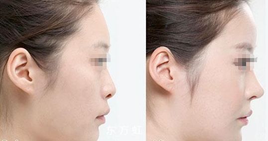 蘇州無(wú)線頻率融脂專(zhuān)科醫(yī)生排名前十這幾位醫(yī)術(shù)聲譽(yù)超卓的醫(yī)生是您的不二之選