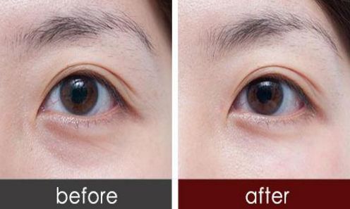 廣州荔灣人民醫(yī)院與中家醫(yī)整容醫(yī)院：醫(yī)療實力PK，看誰更勝一籌