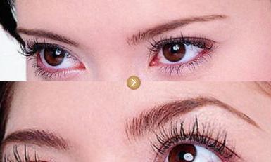 上海眼袋手術(shù)有哪些醫(yī)院推薦？這些醫(yī)療機(jī)構(gòu)醫(yī)術(shù)高超！