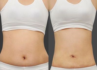 遼陽市整形美容院TOP10排行榜單公布！快來挑選適合你的醫(yī)院！