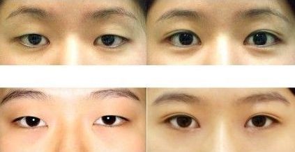 西安眼袋專家醫(yī)生整理盤推薦！排名前五強備受好評！實力驚艷！