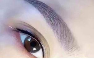 廣州治療內(nèi)眼角凹陷，選擇這幾家醫(yī)院最靠譜