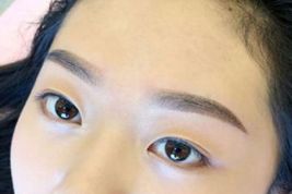 如何優(yōu)雅地?fù)碛须p眼皮？了解專家經(jīng)驗與最新案例！