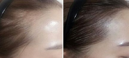 鄭州芳藝醫(yī)療整形醫(yī)院有沒(méi)有特色項(xiàng)目？如何一鍵獲?。? style=