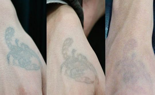 長(zhǎng)沙哪家整形醫(yī)院技術(shù)靠譜？私立醫(yī)美還可信嗎？