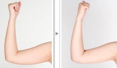 北京新星靚醫(yī)療美容醫(yī)院真的靠譜嗎？李偉民醫(yī)生的資料是怎樣的？