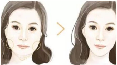成都哪家口碑整形醫(yī)院好？傾情推薦三家實(shí)力不凡的醫(yī)療機(jī)構(gòu)