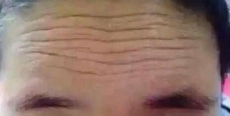 北京整形美容領域醫(yī)院推薦！最受好評的隆鼻醫(yī)院新版名單發(fā)布！