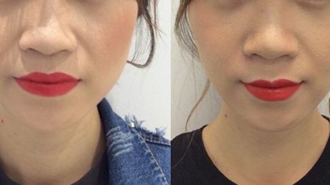 2023年熱議：揭秘重慶市當?shù)貥O具口碑的整容醫(yī)院！