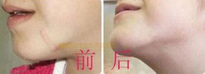 西安醫(yī)美：西京、唐都、高一生等醫(yī)院最受歡迎！最新榜單出爐！