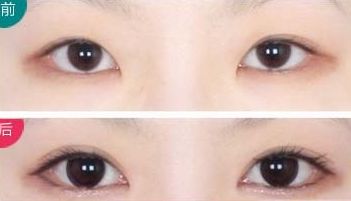 全國頂級整形醫(yī)院奉上前十年度最佳隆胸選擇！專業(yè)可靠服務(wù)，平價優(yōu)惠！
