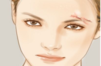 昆明熱瑪吉手術合格專家醫(yī)院匯總，想知道的小伙伴記得收藏！