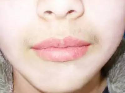 無錫三院整形科哪位醫(yī)生會更受關(guān)注？