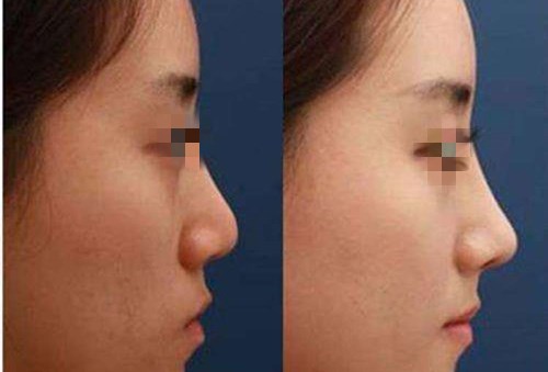 重慶愛思特整形美容醫(yī)院團隊的技術一覽，值得信賴嗎？