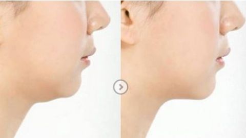 無(wú)錫哪家整形醫(yī)院正規(guī)靠譜？2023曼陀羅、伊爾美等名院是首選！