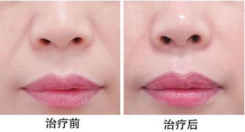 最靠譜的蘇州下頜角整形醫(yī)院推薦，口碑爆棚的醫(yī)療機(jī)構(gòu)評(píng)選
