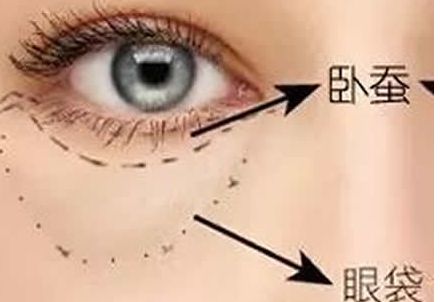 北京協(xié)和醫(yī)院隆胸案例與醫(yī)生簡介含金量如何？收費是否合理？