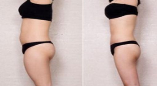 重慶五家優(yōu)秀整形醫(yī)院，值得推薦的附一院和聯(lián)合麗格！