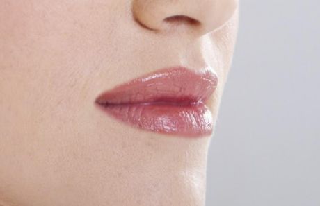 廣醫(yī)一院整形美容科：醫(yī)生實力強，雙眼皮案例為佐證
