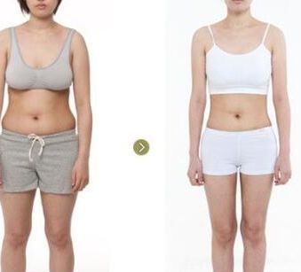 廣州去疤整形醫(yī)院排名前三公布，醫(yī)療界為之驚嘆！