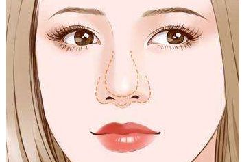 濟南哪家醫(yī)生做雙眼皮效果好？謝燕燕醫(yī)生實力及案例揭秘！