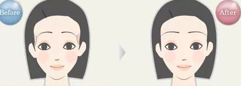 揭密石家莊哪位雙眼皮醫(yī)生備受關(guān)注，優(yōu)點(diǎn)揭秘，價(jià)格參考！