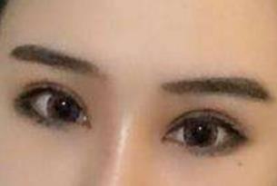 成都大華整形醫(yī)院醫(yī)生有哪些擅長項目？醫(yī)院技術(shù)如何？