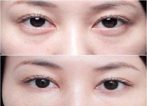 武漢隆胸手術(shù)醫(yī)院2023整友力打造推薦推薦