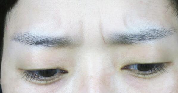 河北醫(yī)科大學第二醫(yī)院項目有哪些？醫(yī)生技術如何提供？