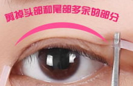 樂山市人民醫(yī)院眼袋手術口碑如何？醫(yī)生推薦+真實案例分析
