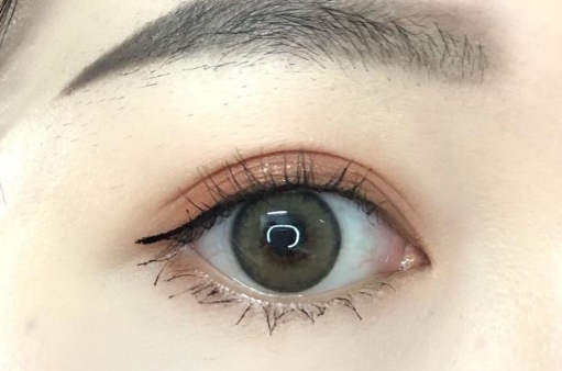 葉秀娣吸脂效果如何？值得一試嗎？