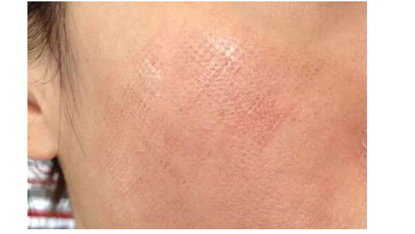 貴陽豐鼻醫(yī)生推薦TOP7專家候選已鎖定，屆時(shí)欽點(diǎn)！