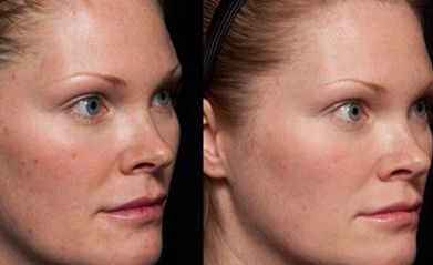 2023年南京磨骨醫(yī)生排行榜！這5位專家大咖讓您眼前一亮！