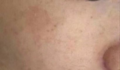 南京優(yōu)質(zhì)雙眼皮修復(fù)醫(yī)生推薦，5位專(zhuān)家點(diǎn)評(píng)述評(píng)