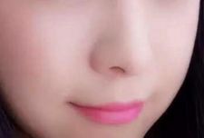 杭州哪家醫(yī)院割雙眼皮效果出眾？推薦藝星、時(shí)光、格萊美等受歡迎醫(yī)療機(jī)構(gòu)