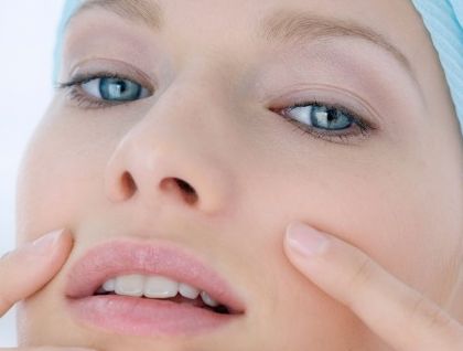 陳嘯醫(yī)生帶您了解蘇北人民醫(yī)院做雙眼皮手術(shù)的招牌案例