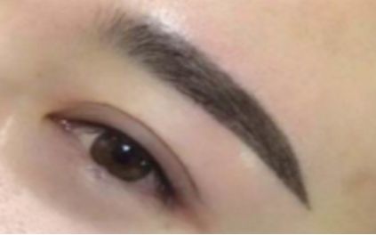 哪家醫(yī)院在武漢享有鼻子整形的最佳聲譽(yù)？推薦這幾家醫(yī)院！