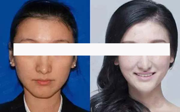 寧波藝星整形和珈禾整形，哪家更具實(shí)力？醫(yī)生口碑、項(xiàng)目擅長(zhǎng)和地址公布等方面的對(duì)比如何？