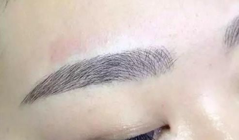 昆明祛斑哪家醫(yī)院更受歡迎？大眾口碑告訴你答案！