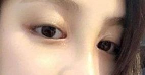 如何選擇合適的醫(yī)生，讓你的身材變得完美無(wú)暇