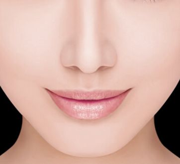哈醫(yī)大四院李巍主治醫(yī)生鼻整形手術(shù)！80天重塑完美鼻型全記錄！