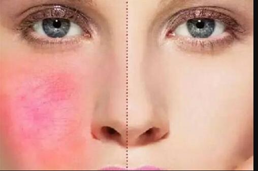 榆林雙眼皮修復(fù)誰的技術(shù)更值得信賴？