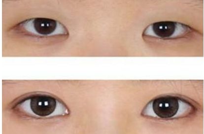 哪家整形醫(yī)院是濟南市最受信賴的？三大醫(yī)療機構(gòu)曝光！