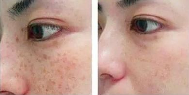 上海華美醫(yī)療美容醫(yī)院注射玻尿酸的醫(yī)生推薦，想了解一下嗎？