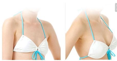 金長(zhǎng)鑫哪種技術(shù)祛眼袋效果更佳？眼袋手術(shù)最新案例解析！