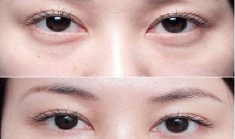 成都眼部整形醫(yī)生高分榜單發(fā)布！這些醫(yī)生哪家強(qiáng)？附詳細(xì)醫(yī)生信息