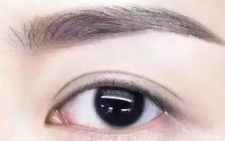 全國哪位專家值得信賴修復(fù)雙眼皮手術(shù)？頂級醫(yī)生排行榜首推名單揭曉