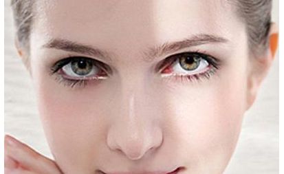 上海九院專家楊嫻嫻的雙眼皮修復(fù)案例及醫(yī)生評價