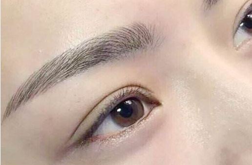 眼袋手術(shù)費(fèi)用及醫(yī)生評(píng)價(jià)與項(xiàng)目分析？