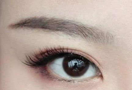 大連王琳雙眼皮的完美實(shí)踐，80天親身體驗(yàn)揭秘